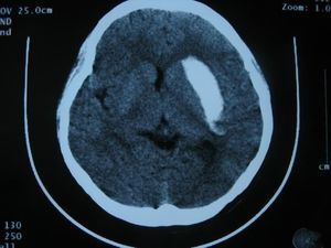 pellicola radiografica per radiografia multidisciplinare 1