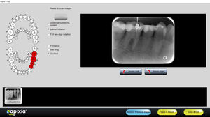 software per imaging odontoiatrico / visualizzatore / di trattamento