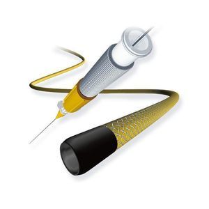 microcatetere per accesso 1