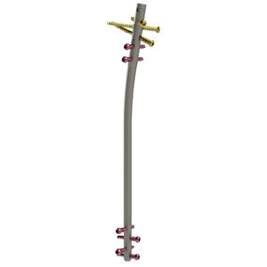 chiodo intramidollare per tibia