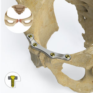 placca di compressione per bacino 1