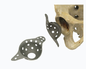 rinforzo acetabolare
