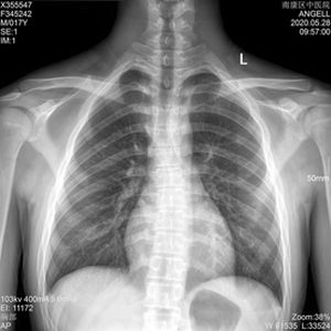 pellicola radiografica per radiografia multidisciplinare