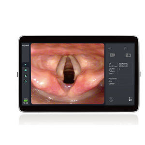 videoprocessore per endoscopia
