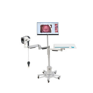 videocolposcopio