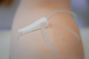 fissaggio per catetere adesivo 1