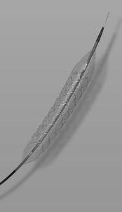stent coronarico