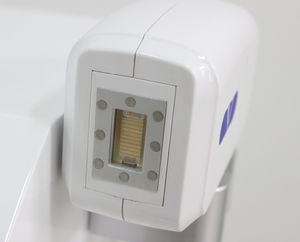 laser per epilazione