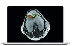 software di visualizzazione