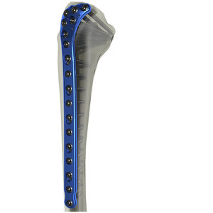 placca di compressione per tibia