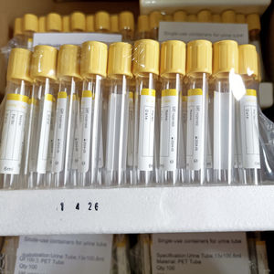 provetta per prelievi da laboratorio