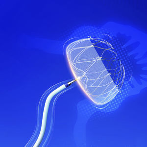 occlusore per occlusione dell'auricolare sinistro 1