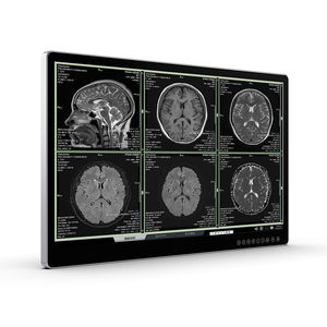 monitor per diagnostica per immagini