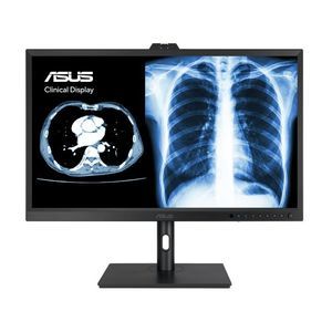 monitor per diagnostica per immagini 1