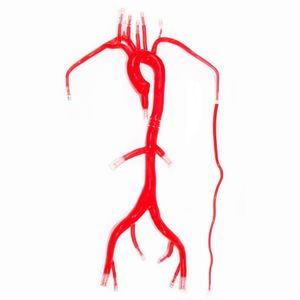 modello vascolare di arteria 1