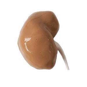 modello anatomico rene 1