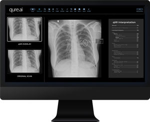 software per radiologia