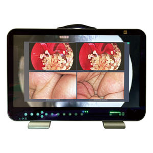 videocamera per endoscopio