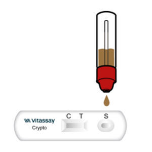 test rapido per malattie gastrointestinali