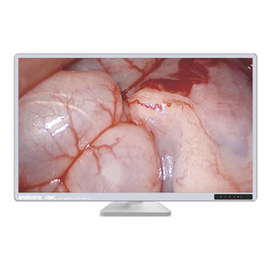 monitor per endoscopia