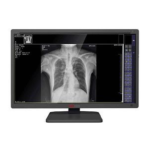 monitor medico 1
