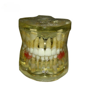 modello anatomico di dentatura