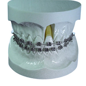 modello anatomico di dentatura 1