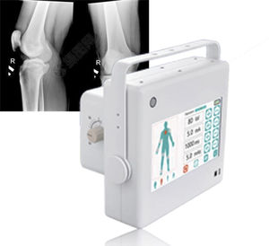 generatore di raggi X per radiografia multidisciplinare