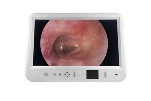 sistema di imaging endoscopico EUS