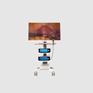 fotocamera endoscopica