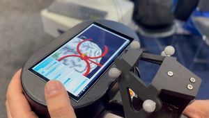 sistema di neuronavigazione per TMS