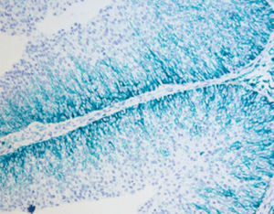 kit di reagenti colorante 1
