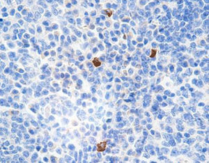 reagente per immunoglobuline G4 1
