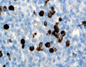 reagente d'immunoglobulina G 1