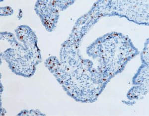 reagente anticorpo monoclonale 1