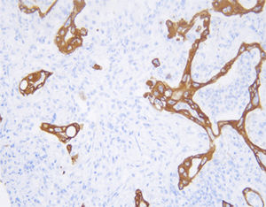 reagente anticorpo monoclonale 1