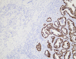 reagente anticorpo monoclonale 1