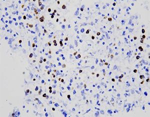 kit di test oncologico 1
