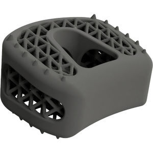 gabbia intersomatica cervicale