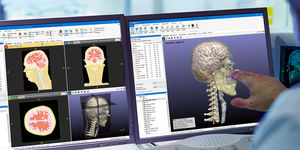 software per diagnostica per immagini