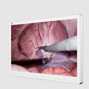 monitor per endoscopia 1