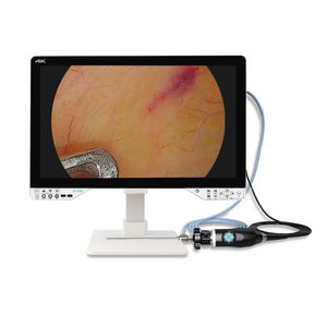 fotocamera per endoscopio 1