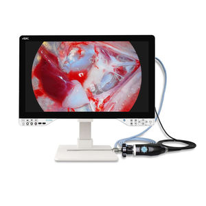 fotocamera per endoscopio 1