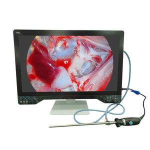 fotocamera per endoscopio 1