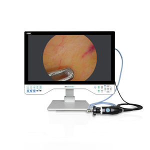 fotocamera per endoscopio 1