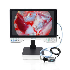 fotocamera per endoscopio 1