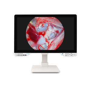 fotocamera per endoscopio 1