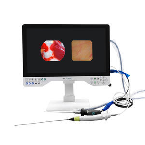 fotocamera endoscopica 1