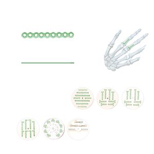 placca di compressione per falange della mano