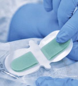 fissatore per catetere intravenoso